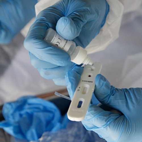 Atibaia realiza testes rápidos em diversas categorias de profissionais
