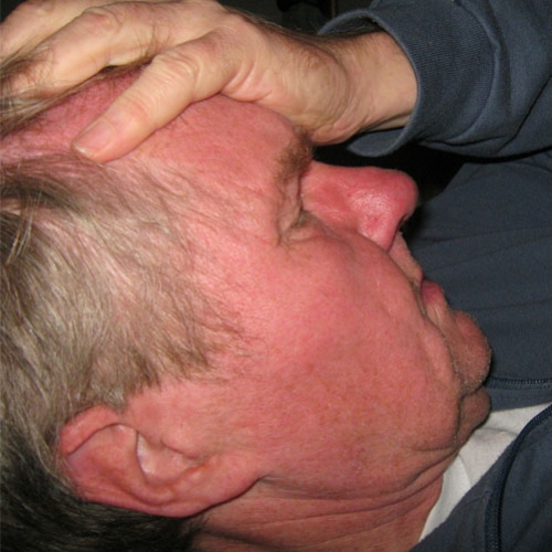 Acidente Vascular Cerebral (AVC): Conhecer para prevenir